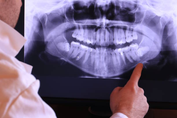 Best Emergency Treatment for Dental Infections or Abscesses in Moore, OK